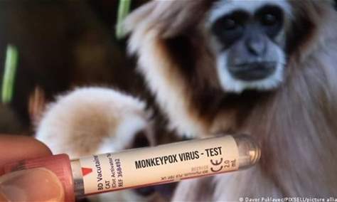 الصحة العالمية: لا خوف حالياً من تحوّل جدري القردة إلى جائحة