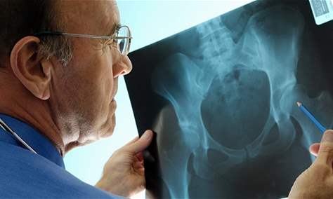 مرض قد يصيب مليار شخص بحلول 2050