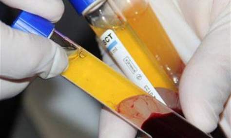 بلازما الدم .. أمل جديد لإنقاذ المصابين بكورونا